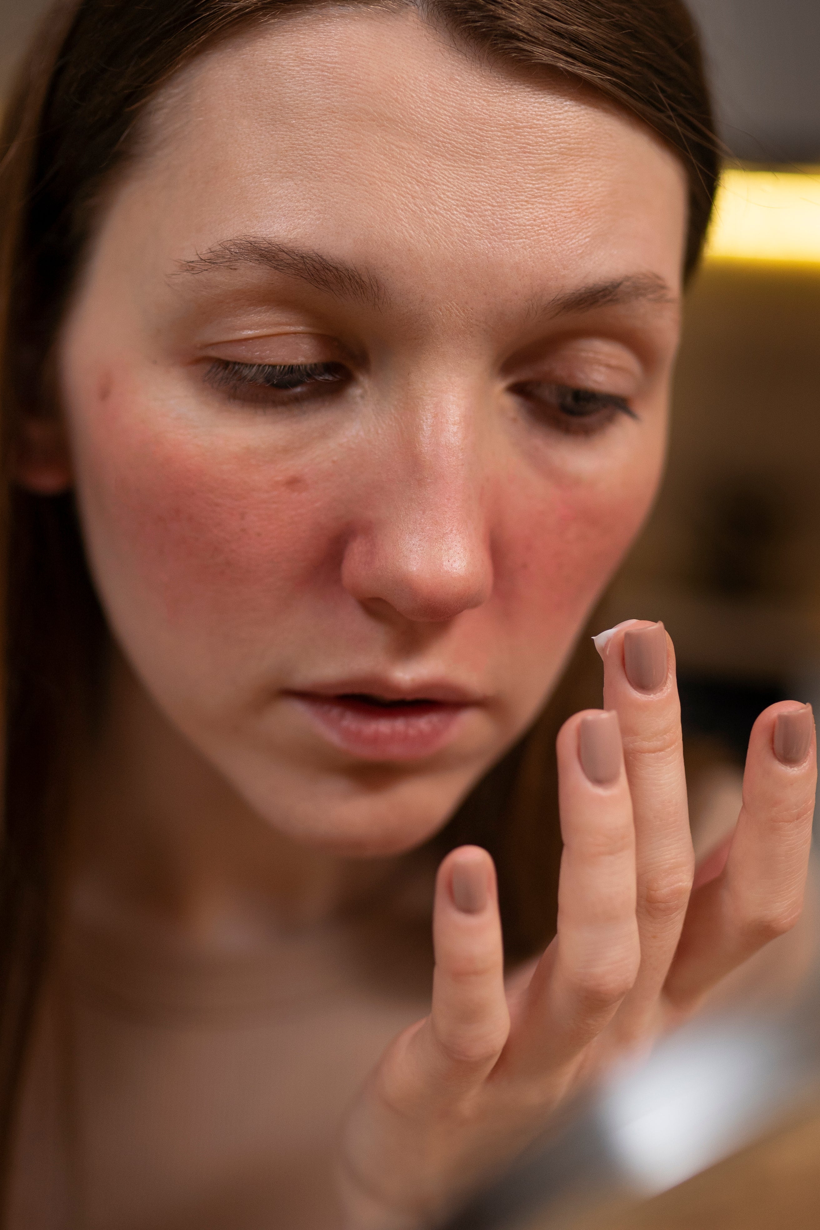 Barrière cutanée endommagée : comment la réparer naturellement ?