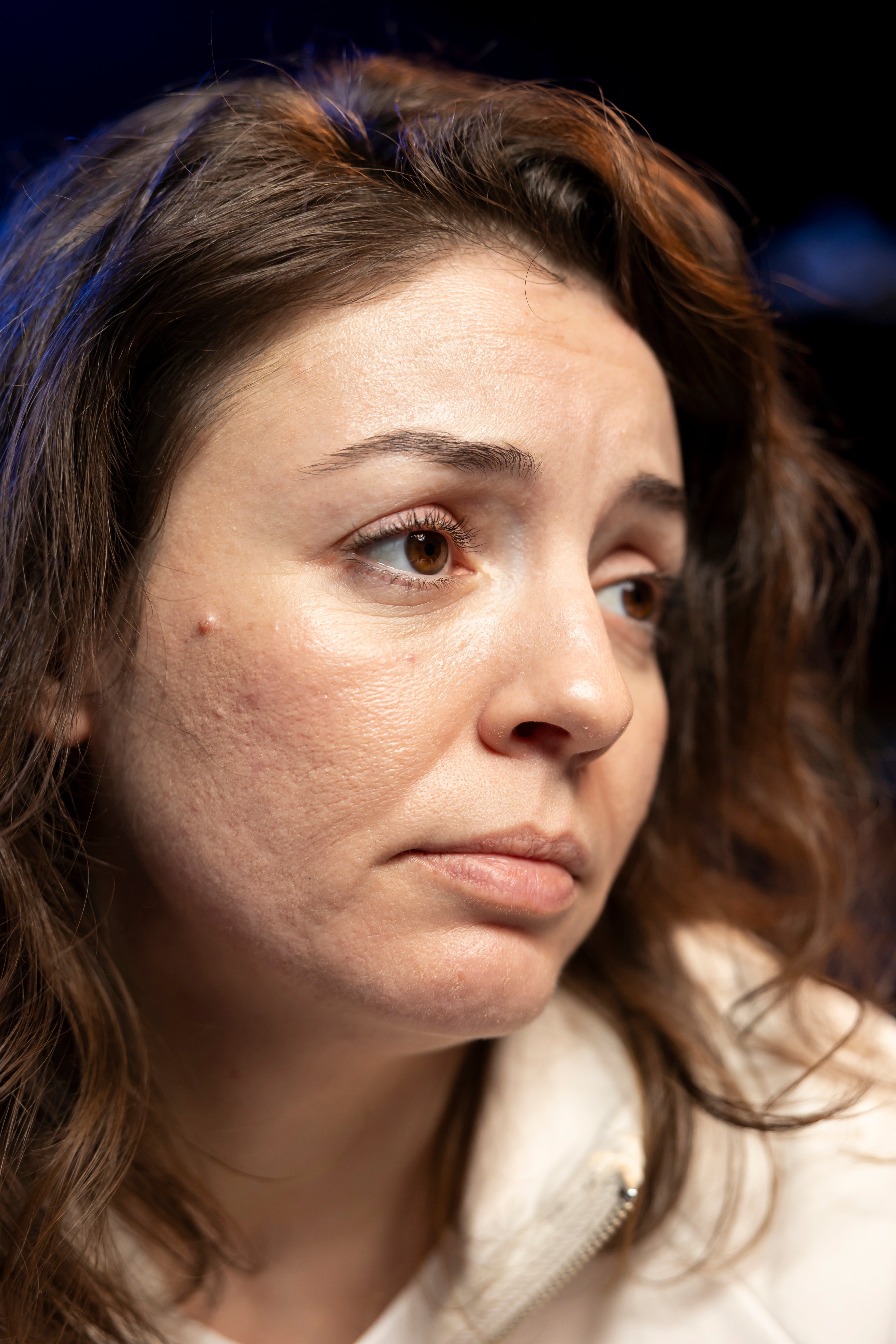 Peau tiraillée : pourquoi ça arrive et comment y remédier naturellement ?