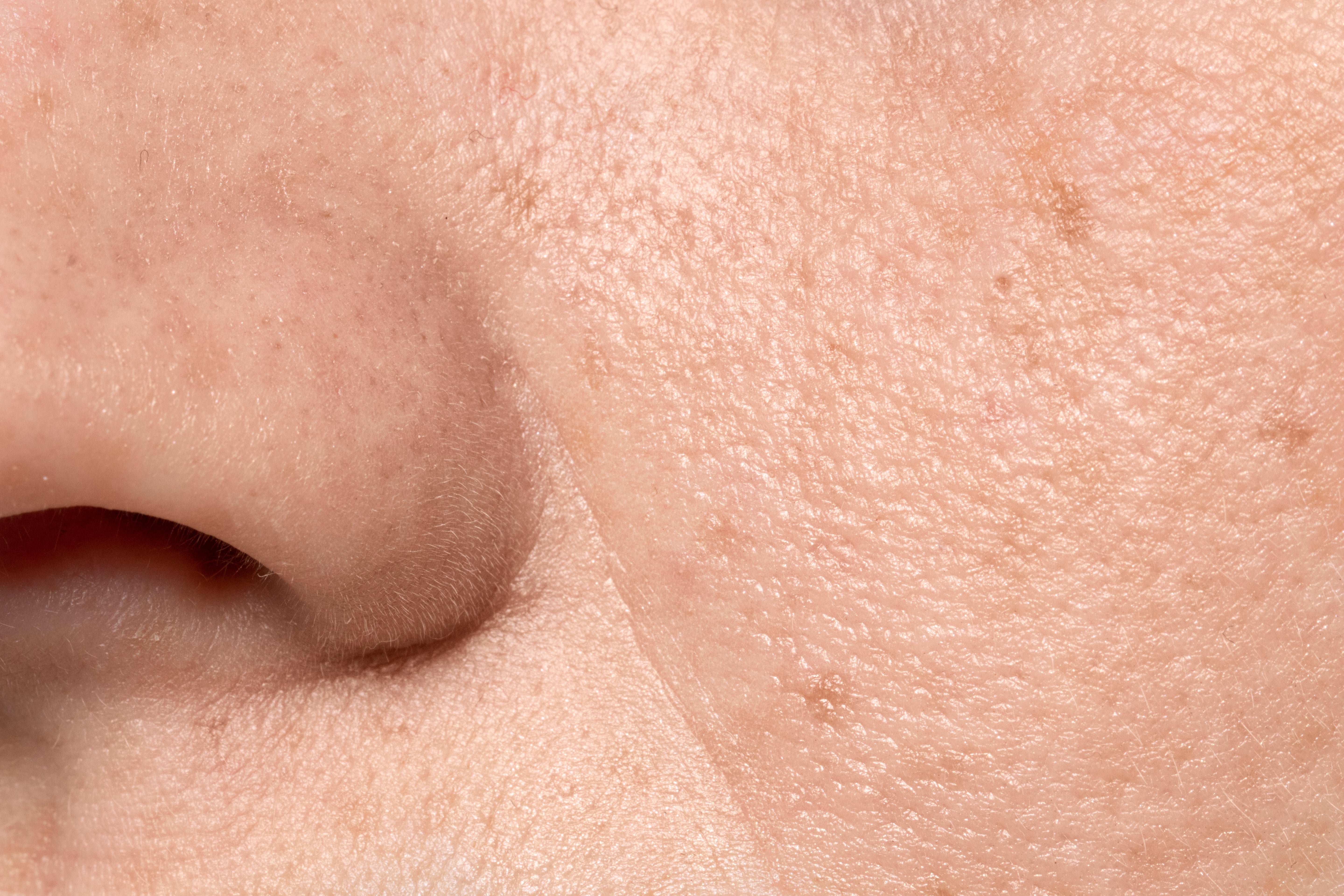 Pores visibles du visage : pourquoi apparaissent-ils et comment les resserrer ?