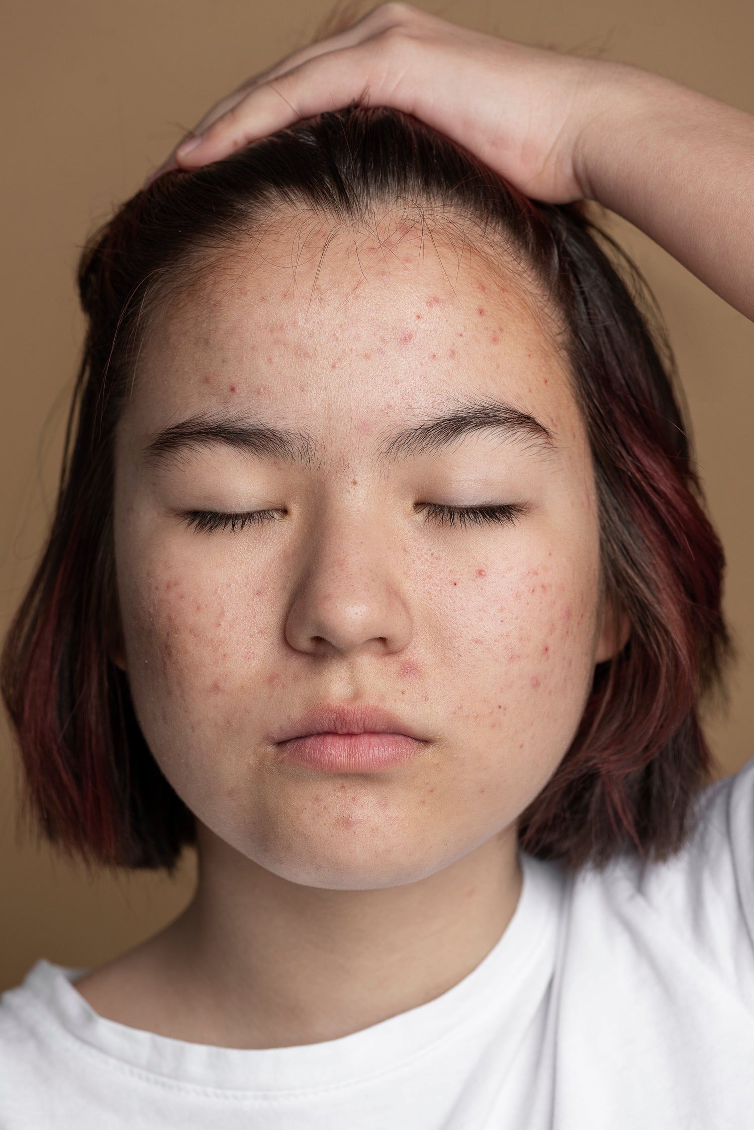 Pourquoi votre peau produit trop de sébum (et comment rééquilibrer naturellement) ?