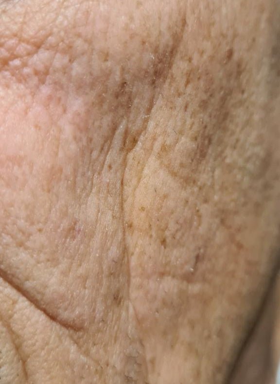 Ridules et rides : comment lisser la peau et retrouver un teint plus uniforme