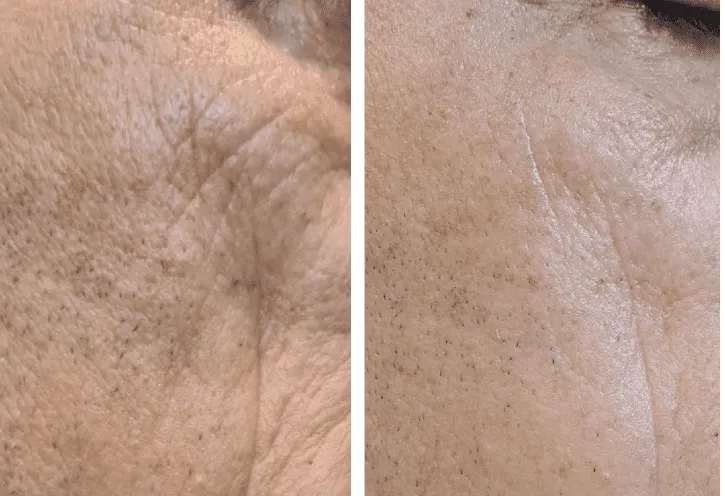Soin Lissant Unifiant aux Rétino-Peptides – Image 4